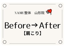 ナオル整体 山形院(NAORU整体)/Before→After