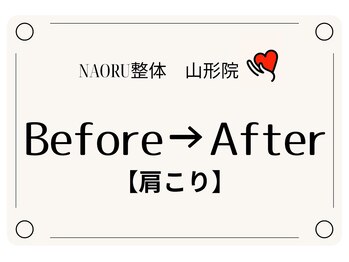 ナオル整体 山形院(NAORU整体)/Before→After