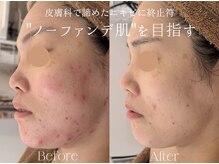 エービューティーサロン 松山店(A BEAUTY SALON.)
