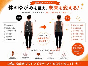 シルエットの写真/【猫背・O脚・側弯対応】初回体験11,000円→口コミ投稿で無料!完全個室マシンピラティスで姿勢改善!ペア◎