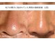 アイリス(iris)の写真/【メンズ歓迎】複雑化した肌トラブル・年齢によるたるみ毛穴・・セルフケア悩みも一緒に解決◎