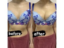 エムエム(mm)/30代女性/バストアップ/