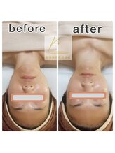 せせら 代々木上原店/深層までアプローチ→最強排出！