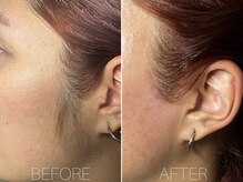 エヴァワックス 恵比寿店(Eva Wax)/話題☆もみあげ脱毛でスッキリ！