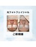 【美肌陶器肌コース☆】 光フォトIPL＋ラジオ波¥9,900→