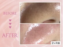 クリアラボ 錦糸町(Clear Lab)/韓国肌管理&毛穴洗浄専門店