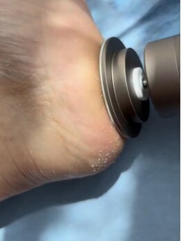 角質ケアができるサロン