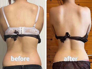 エミニーライフ(EMINY LIFE)/１ヶ月モニタービフォーアフター