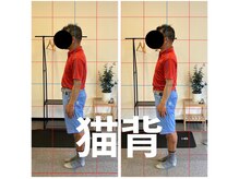 カワル整体 長嶺院/猫背