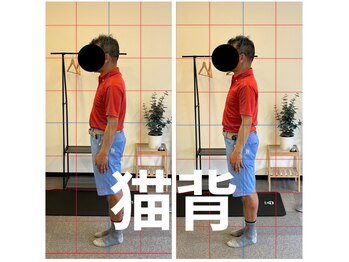 カワル整体 長嶺院/猫背