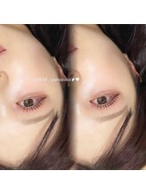 ルナビューティー(Luna beauty)/