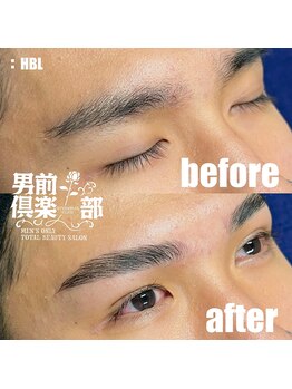 男前倶楽部/脱毛/メンズ脱毛/メンズ専門店