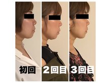 クラウドナインエステティック(Cloud Nine esthetic)の雰囲気（目で見える変化☆自分史上最高の小顔へ♪）