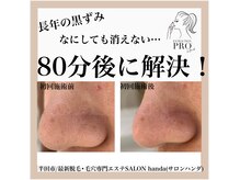 サロン 半田店(SALON)の雰囲気（話題の【毛穴プロ】であなたの毛穴悩みを解決◎ 半田/毛穴）