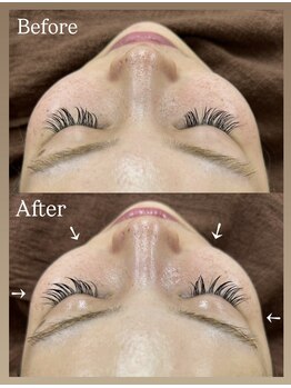 コーラル(CORAL)/*小顔リンパフェイシャル40分*