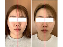 ビューティフルムーン(Beautiful Moon)/小顔矯正&小顔デザイン