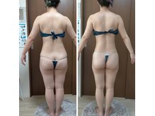痩身 脱毛専門サロン 椿の雰囲気（上半身→下半身の順番で２ヶ月後の変化！別人！）