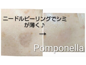 ポンポネッラ