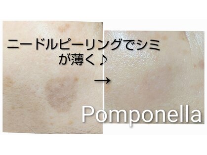 ポンポネッラの写真