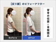 見た目・体の変化にこだわる本格整体◎【整体/肩こり/腰痛】