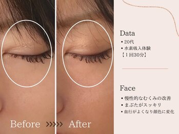 ヨサパーク すずのね(YOSA PARK)/水素吸入のみ体験