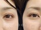 プール 鹿児島中央駅店(POOL)の写真/「綺麗つづく」圧倒的キープ力！バラつきを抑えつけたてのカールが続く高技術の持続性を体験してください♪