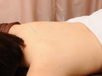 ふわりはり灸整体院/首肩背中のコリに♪