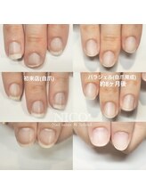 ニコプラス(NICO+)/自爪育成中