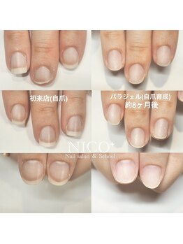 ニコプラス(NICO+)/自爪育成中