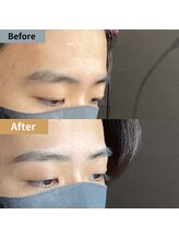 眉毛ハウス 吉祥寺店(眉毛HOUSE)/お客様の施術例(吉祥寺/東京)