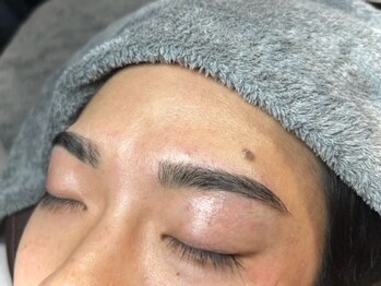 ナディオ 新宿(NADIO)の写真/【ご新規様☆フェイシャルワックス¥3000】男性オーナー施術/完全個室◎男性の為に作った脱毛店♪