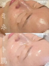 ゼアー(THERE FY.)&nbsp;ラミネーシ ョンピール