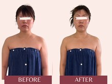 アンリール(Anrire)/【板橋/フェイシャルエステ】