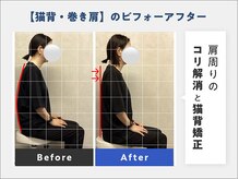 肩甲骨はがしで可動域を広げ、肩こり＆猫背改善◎【整体/腰痛】