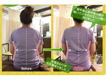 デトックス(Detox)の写真/通うたび、私が整っていく。どこから見ても美しいライン、姿勢へ＊個室での施術なので人目が気にならない◎