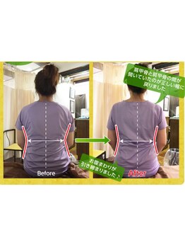 体の歪みをとりたい