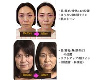 姿勢改善/女性受付スタッフ在籍/肩こり/小顔/フェイシャル/整体