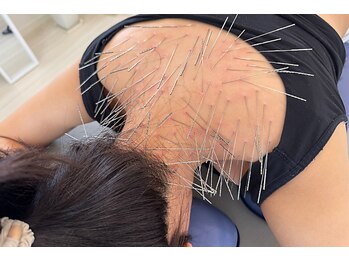 シラカワ 小倉院(SHIRAKAWA)の写真/顔の悩みの原因は、首肩にあることが多いです