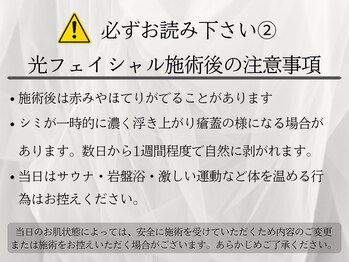 ルーチェ(LUCE)/光フェイシャル注意事項2