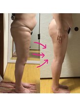 ピアリーノ(Pialino)/