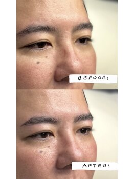 ヌック(NO-K)/ハリウッドブロウリフト