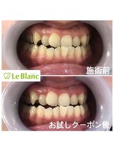 ルブラン 奈良店(Le Blanc)/歯はごまかしがききません！
