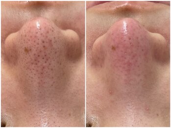 ミュー 金山店(mieux)/お悩みご相談ください