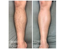 ベイビースキン(Baby skin)の雰囲気（【脱毛】メンズ脱毛も大歓迎◎）