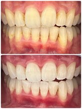 ハモットホワイト(Hamotto White)/照射1日目☆