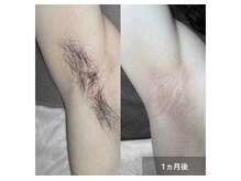 ネオオアシス トウキョウ(ネオOASIS TOKYO)の雰囲気（濃い部分の毛にも効果的！〈脱毛/ワックス脱毛〉）