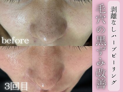 リネ(Rine)の写真