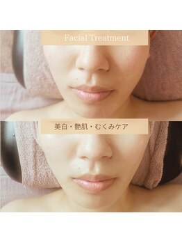 ケーオーガニックエトワールラメール(Korganic etoiles la mere)の写真/〈オーダーメイドトリートメント〉ほうれい線/たるみ改善/シミやシワ緩和などエイジングケアにぴったり♪