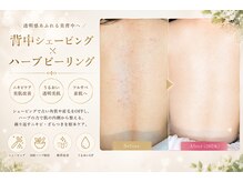 リンク(LiNK)の雰囲気（背中全面腰辺りまで全てツルツル/腕や手/デコルテ気になる所全て）