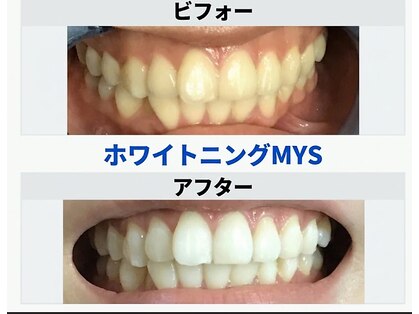 ホワイトニングミース 北千住店(MYS)の写真